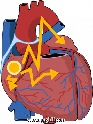 Sanode Clipart